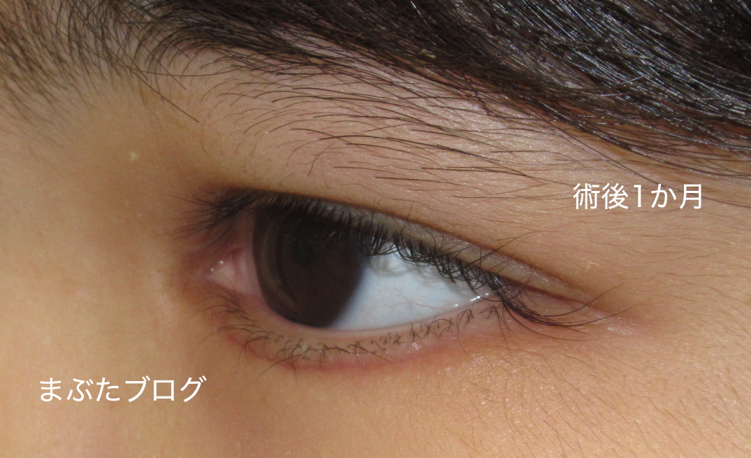 f:id:tomitooji:20200502110838j:plain