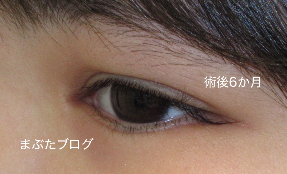 f:id:tomitooji:20200502111056j:plain