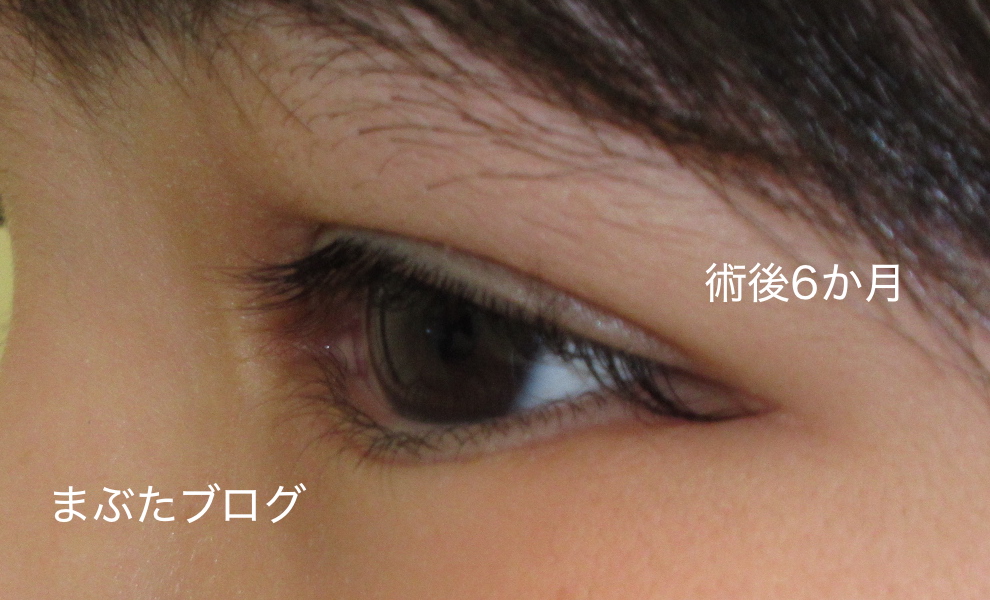 f:id:tomitooji:20200502111125j:plain