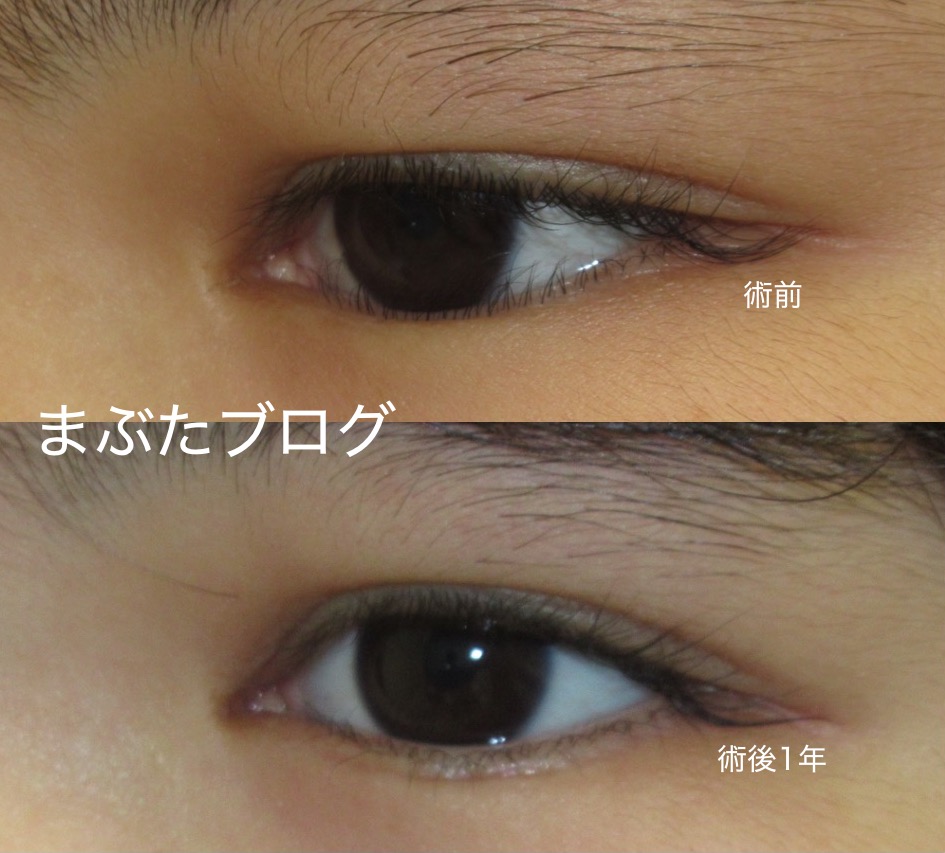 f:id:tomitooji:20200502113050j:plain