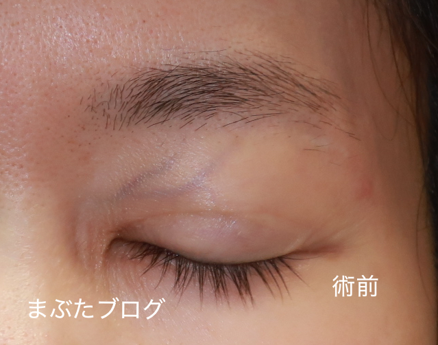 f:id:tomitooji:20200925171055j:plain