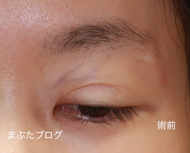 f:id:tomitooji:20200925171123j:plain