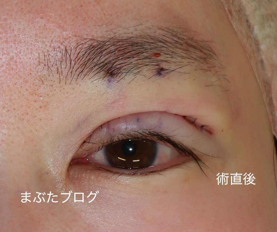 f:id:tomitooji:20200925171652j:plain