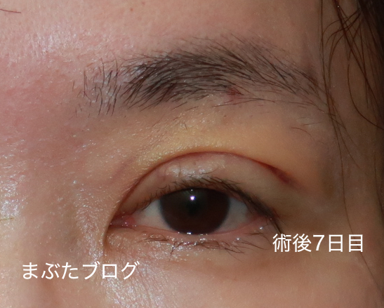 f:id:tomitooji:20200925171901j:plain