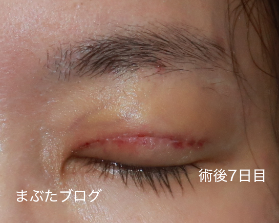 f:id:tomitooji:20200925171914j:plain