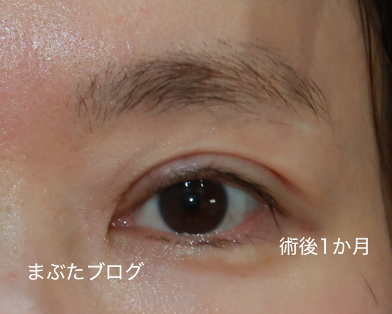 f:id:tomitooji:20200925172007j:plain