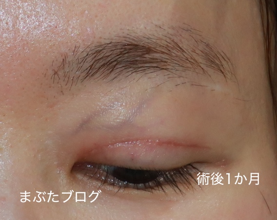f:id:tomitooji:20200925172035j:plain