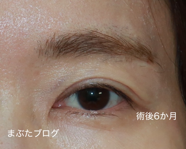 f:id:tomitooji:20200925172316j:plain