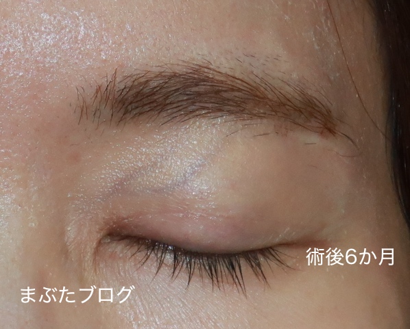 f:id:tomitooji:20200925173024j:plain