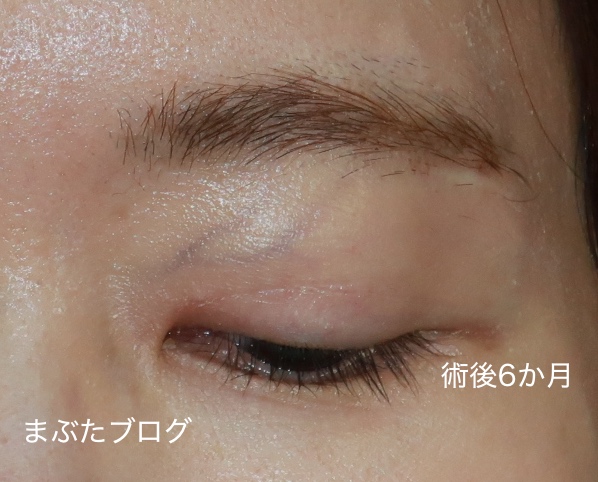 f:id:tomitooji:20200925173038j:plain
