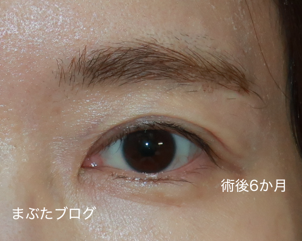 f:id:tomitooji:20200925173051j:plain