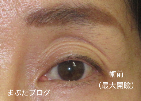 f:id:tomitooji:20201017161617j:plain