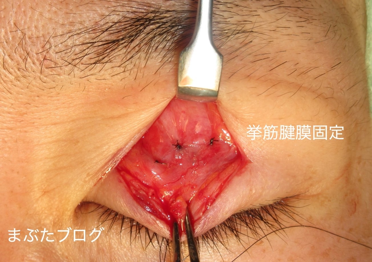 f:id:tomitooji:20201017162723j:plain