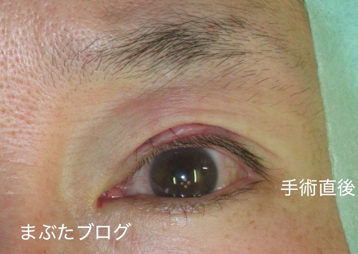 f:id:tomitooji:20201017162836j:plain
