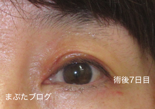 f:id:tomitooji:20201017163249j:plain