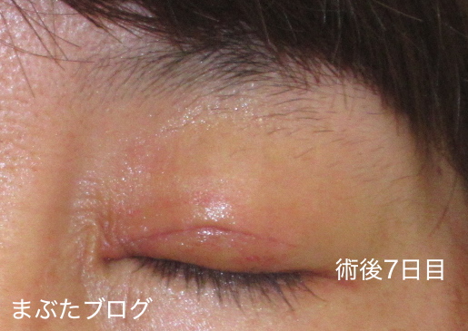 f:id:tomitooji:20201017163421j:plain
