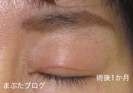 f:id:tomitooji:20201017163644j:plain