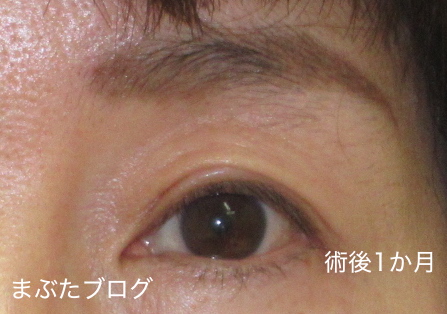 f:id:tomitooji:20201017163702j:plain
