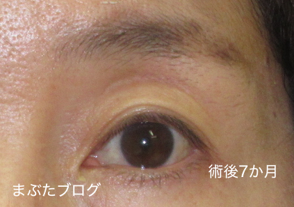 f:id:tomitooji:20201017164111j:plain