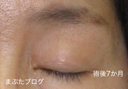 f:id:tomitooji:20201017164147j:plain