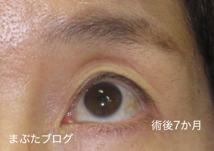 f:id:tomitooji:20201017164226j:plain