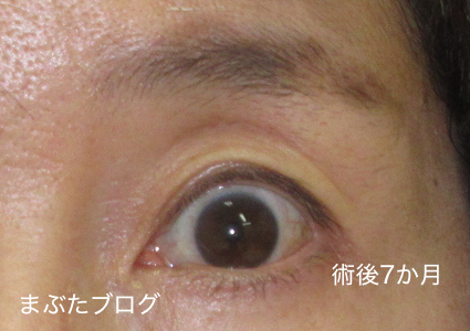 f:id:tomitooji:20201017164255j:plain