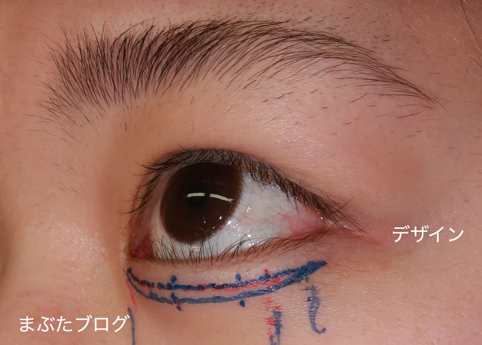 f:id:tomitooji:20201118131052j:plain