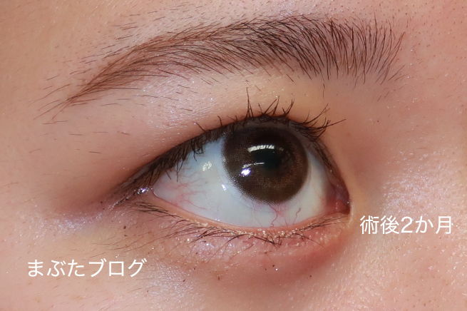f:id:tomitooji:20201118132232j:plain