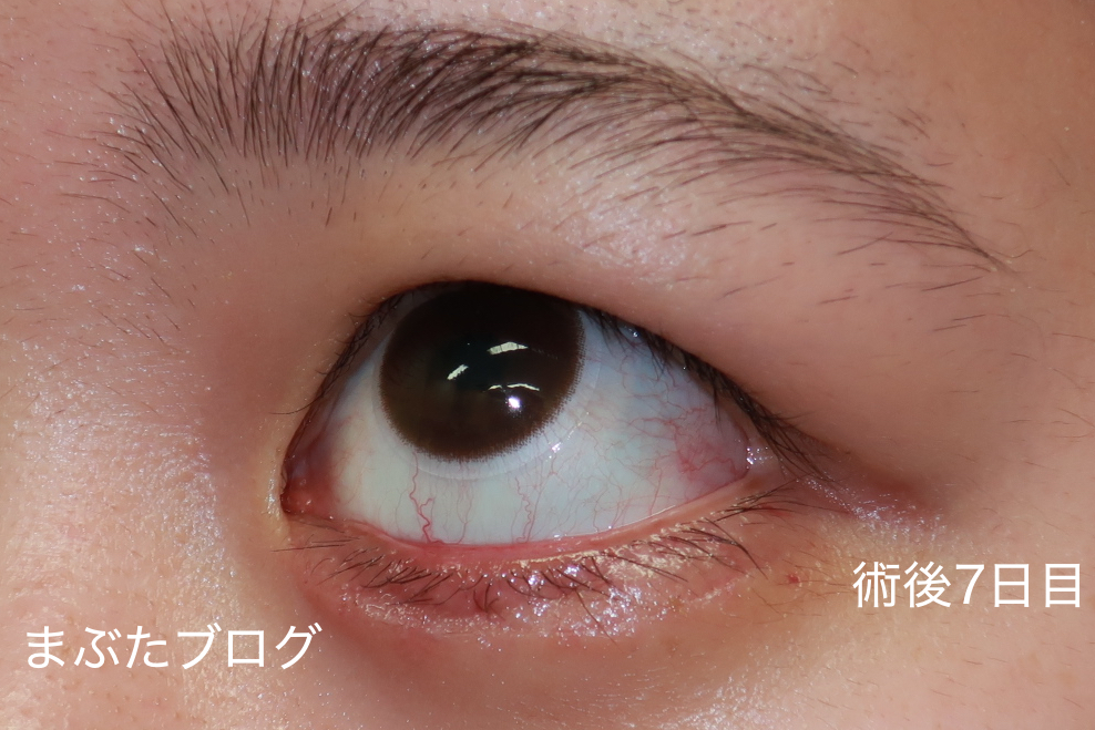 f:id:tomitooji:20201118132427j:plain