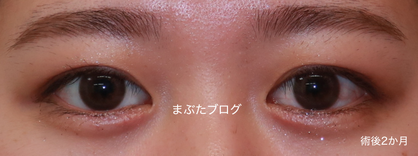 f:id:tomitooji:20201118132604j:plain