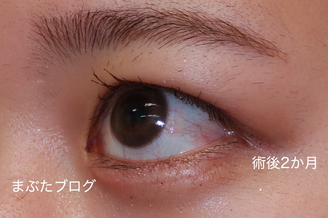 f:id:tomitooji:20201118133214j:plain