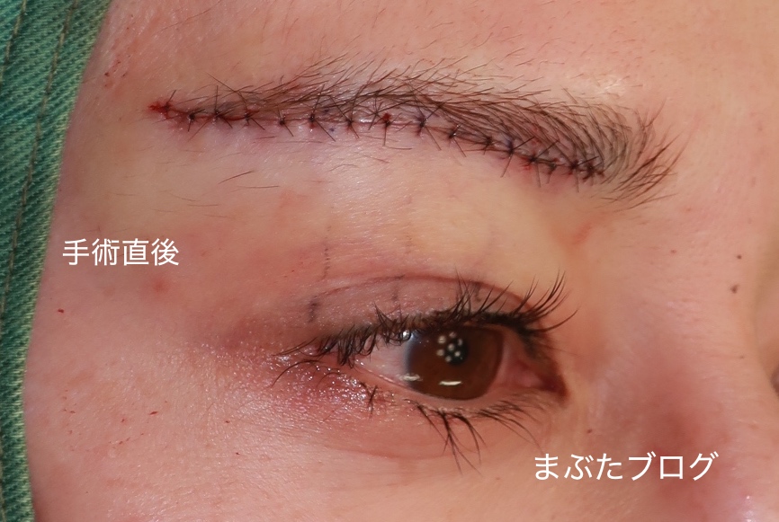 f:id:tomitooji:20210213181436j:plain