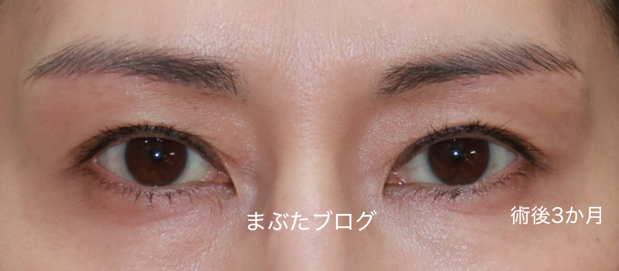f:id:tomitooji:20210213183833j:plain