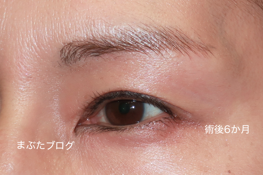 f:id:tomitooji:20210213184652j:plain