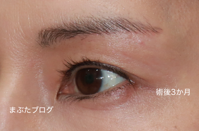 f:id:tomitooji:20210213184816j:plain