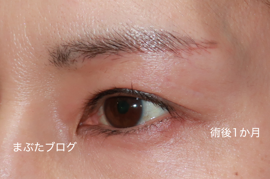 f:id:tomitooji:20210213184903j:plain