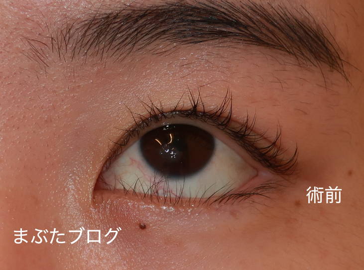f:id:tomitooji:20210617002818j:plain