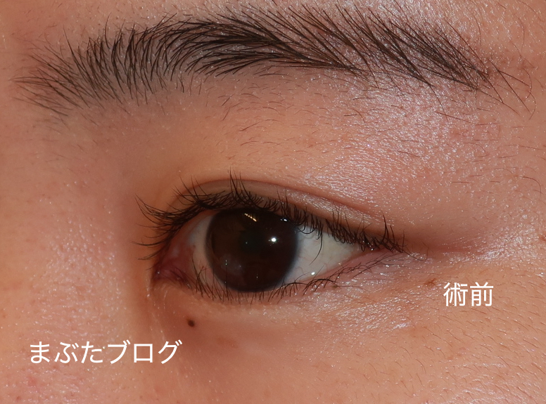 f:id:tomitooji:20210617002907j:plain