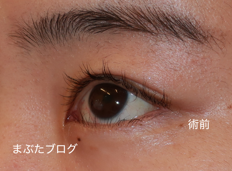 f:id:tomitooji:20210617002929j:plain
