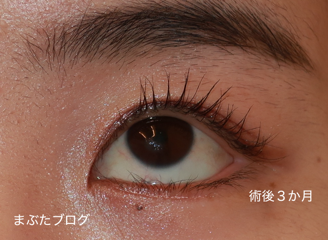 f:id:tomitooji:20210617152403j:plain