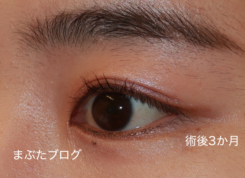 f:id:tomitooji:20210617152433j:plain