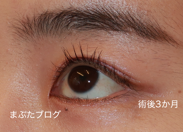 f:id:tomitooji:20210617152452j:plain