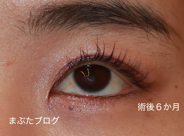 f:id:tomitooji:20210617152855j:plain