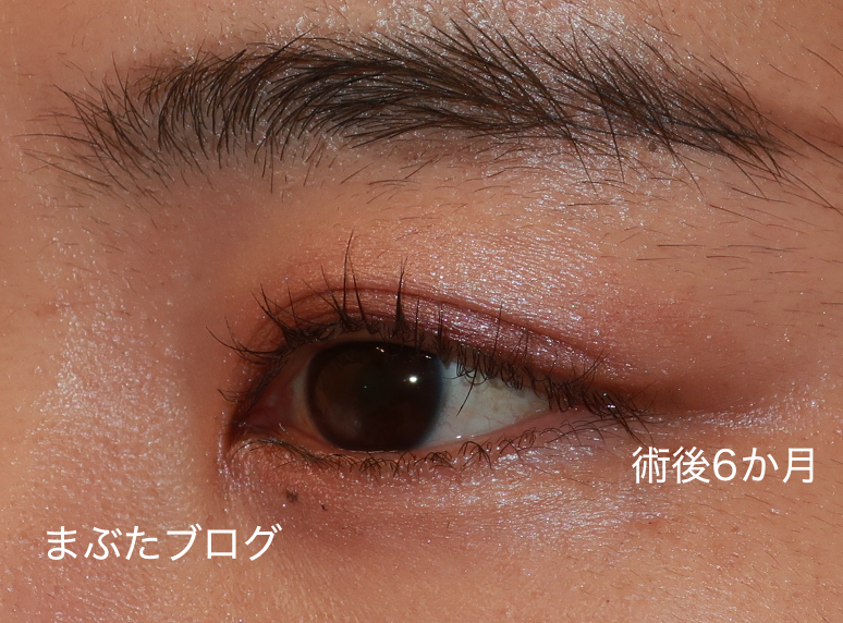 f:id:tomitooji:20210617152921j:plain