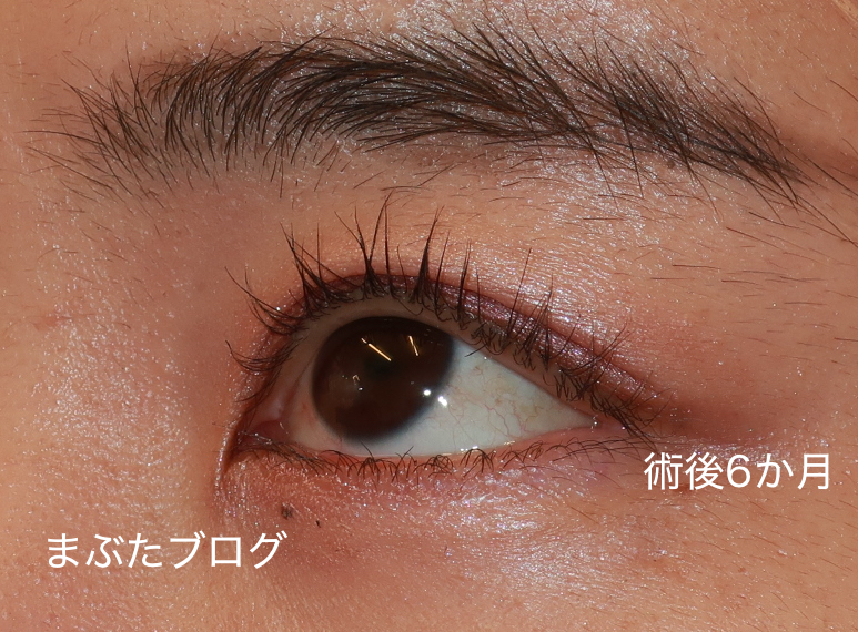 f:id:tomitooji:20210617153215j:plain