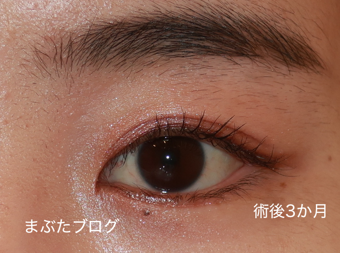 f:id:tomitooji:20210617175540j:plain