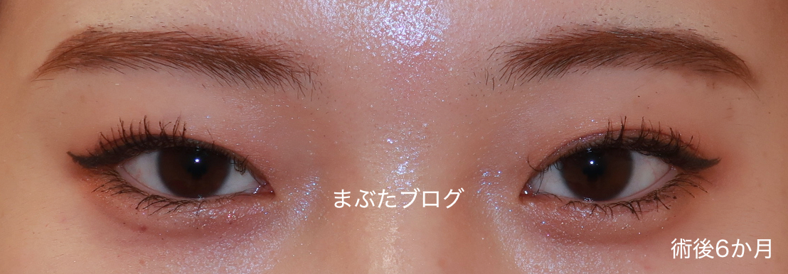 f:id:tomitooji:20210911000758j:plain