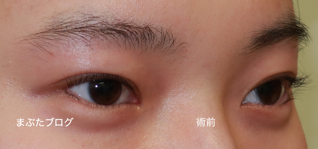 f:id:tomitooji:20210911001208j:plain