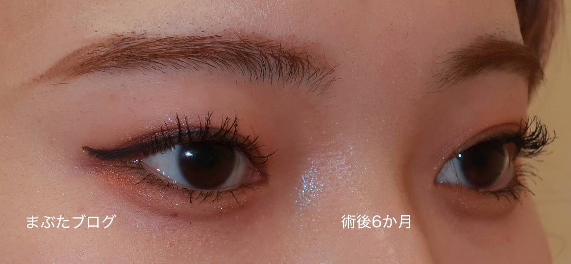 f:id:tomitooji:20210911001222j:plain