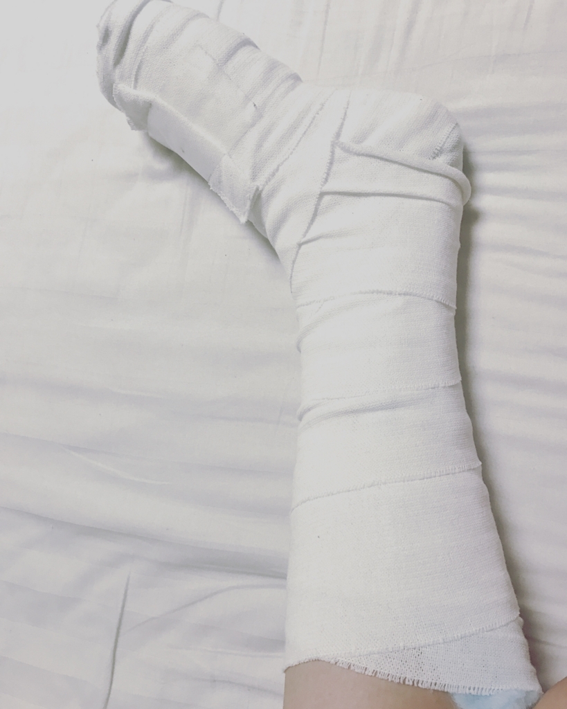 まさかの再手術 アキレス腱断裂系女子